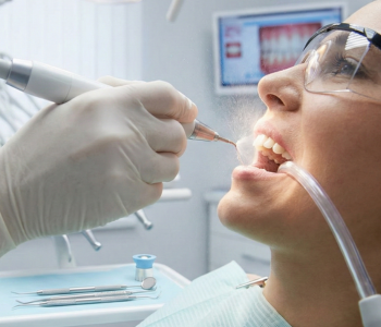 Dental Cleaning Service