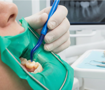 Dental Filling Service